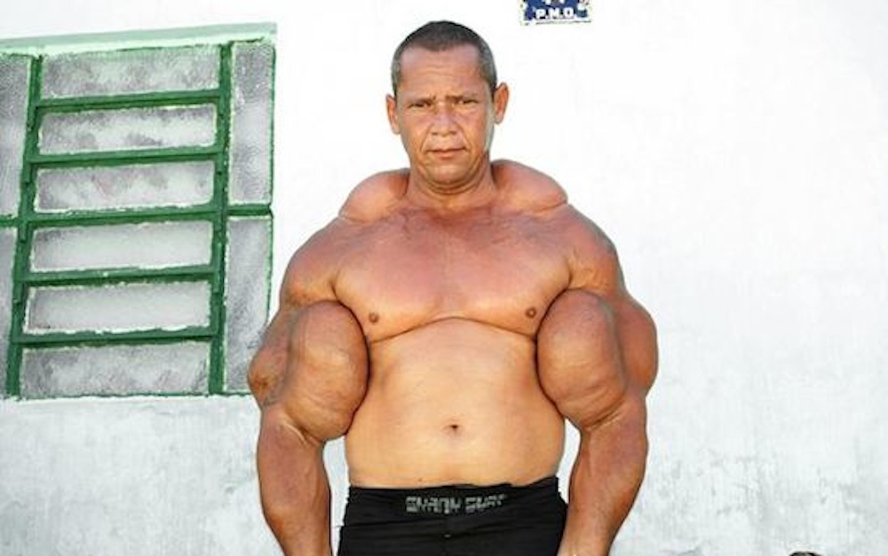 synthol explosion on stage