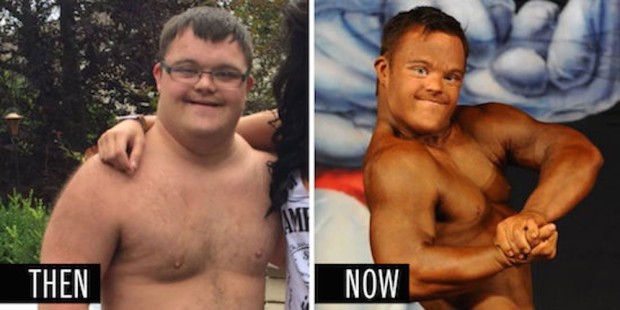 Check Out The Incredible Transformation Of This Bodybuilder With Downs Syndrome Sick Chirpse