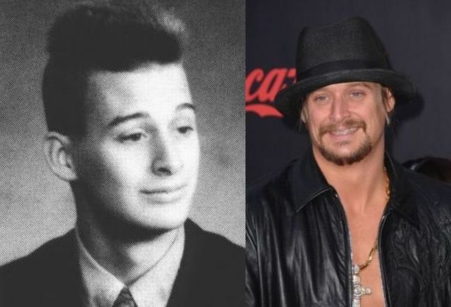 kid rock young