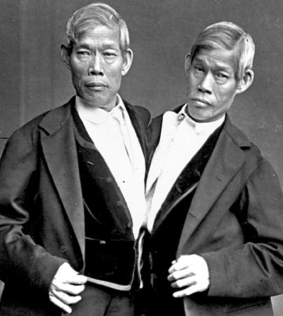 Chang Eng Bunker - Siamese Twins - Later Years 3