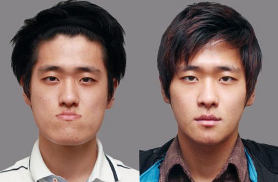 Crazy Before And After Photos Of South Korean Plastic Surgery 