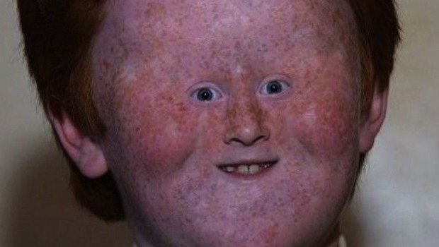 how-many-ginger-people-in-the-world-sick-chirpse