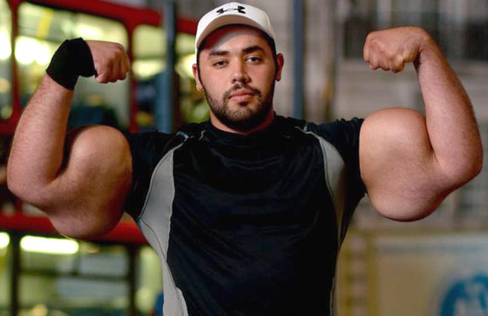 5 Things You Need To Know Before Using Synthol