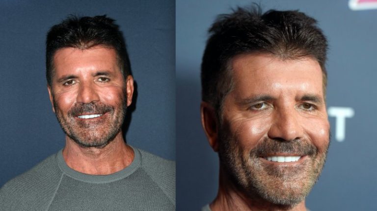 The Internet Is Freaking Out About Simon Cowell's New Face