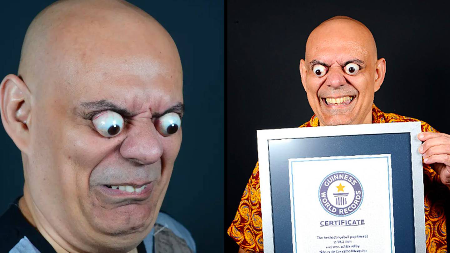 Man Sets New Guinness World Record For Worlds Largest Eyeball Pop